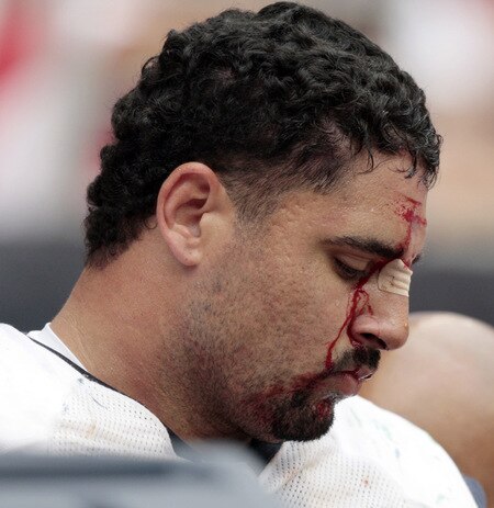 HOUSTON - SEPTEMBER 13:  Defensive tackle Shaun Cody #95 of the Houston Texans is treated on the sidelines after taking a hard hit at Reliant Stadium on September 13, 2009 in Houston, Texas.  <br /><br /><span class="help">(Photo by Bob Levey/Getty Images)</span>