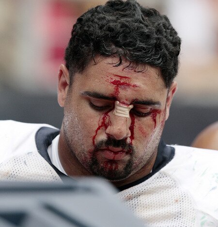 HOUSTON - SEPTEMBER 13:  Defensive tackle Shaun Cody #95 is treated on the sidelines after taking a hard hit at Reliant Stadium on September 13, 2009 in Houston, Texas.  <br /><br /><span class="help">(Photo by Bob Levey/Getty Images)</span>