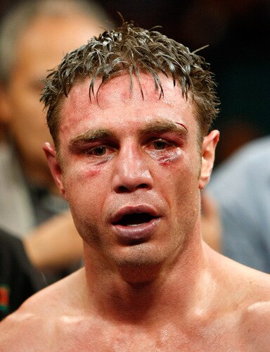 LAS VEGAS - SEPTEMBER 19:  Michael Katsidis appears after defeating Vincent Escobedo to win the WBO interim lightweight title at the MGM Grand Garden Arena September 19, 2009 in Las Vegas, Nevada. Katsidis won the fight by split decision.  <br /><br /><span class="help">(Photo by Ethan Miller/Getty Images)</span>