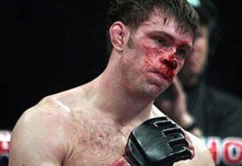 Forrest_griffin1_crop_340x234