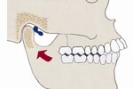 Jaw_images_crop_150x100
