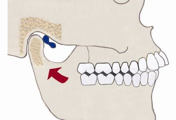 Jaw_images_feature