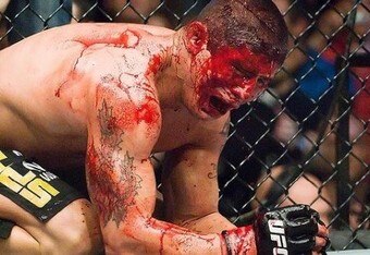Joe-daddy-stevenson-at-ufc-80-4_crop_340x234