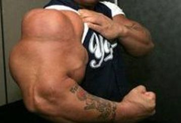Biceps62_feature