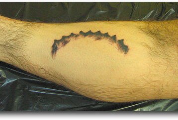 Chainring_calf_feature