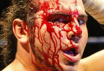 Mattbleeds_crop_340x234