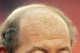 LANDOVER, MD - SEPTEMBER 11:  TV commentator Tony Kornheiser looks on before a game between the Minnesota Vikings and the Washington Redskins before the first Monday Night Football game of the season on at FedEx Field September 11, 2006 in Landover, Maryland.  (Photo by Jamie Squire/Getty Images)