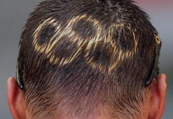 BEIJING - AUGUST 22: The Olympic rings are seen on the head of Kazimir Verkin of Slovakia after his last ever 50km Walk at the National Stadium on Day 14 of the Beijing 2008 Olympic Games on August 22, 2008 in Beijing, China.  (Photo by Mark Dadswell/Getty Images)