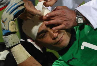 RUSTENBURG, SOUTH AFRICA - JUNE 21:  Essam El Hadary of Egypt recieves medical treatment during the FIFA Confederations Cup match between Egypt and USA at Royal Bafokeng Stadium on June 21, 2009 in Rustenburg, South Africa.  (Photo by Jamie McDonald/Getty Images)