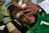 RUSTENBURG, SOUTH AFRICA - JUNE 21:  Essam El Hadary of Egypt recieves medical treatment during the FIFA Confederations Cup match between Egypt and USA at Royal Bafokeng Stadium on June 21, 2009 in Rustenburg, South Africa.  (Photo by Jamie McDonald/Getty Images)