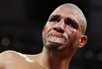 NEW YORK - JUNE 13:  Miguel Cotto fights with a cut after an accidental  head butt by Joshua Clottey during their WBO Welterweight title fight at Madison Square Garden  on June 13, 2009 in New York, New York.  (Photo by Al Bello/Getty Images)