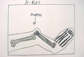 Break_a_leg_feature