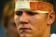 GLASGOW, SCOTLAND - JUNE 23: Australia's battered and bruised Josh Valentine after losing the semi final IRB U21's World Championships match between Australia and Ireland at Hughenden on June 23, 2004 in Glasgow, Scotland.  (Photo by Christopher Furlong/Getty Images)