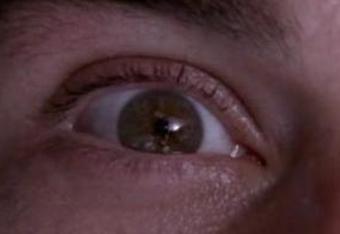 Eye_crop_340x234
