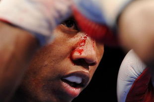 NEW YORK - NOVEMBER 08:  Zab Judah fights against Ernest Johnson while blood drips down his face during their Welterweight bout at Madison Square Garden November 8, 2008 in New York City.  (Photo by Al Bello/Getty Images)