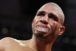 NEW YORK - JUNE 13:  Miguel Cotto fights with a cut after an accidental  head butt by Joshua Clottey during their WBO Welterweight title fight at Madison Square Garden  on June 13, 2009 in New York, New York.  (Photo by Al Bello/Getty Images)