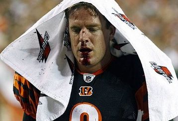 Carson_palmer2662--nfl_small_50_feature