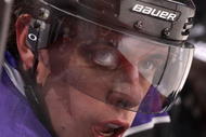 GLENDALE, AZ - NOVEMBER 02:  Anze Kopitar #11 of the Los Angeles Kings watches from the bench during the NHL game against the Phoenix Coyotes at Jobing.com Arena on November 2, 2009 in Glendale, Arizona.  The Kings defeated the Coyotes 5-3.  (Photo by Christian Petersen/Getty Images)