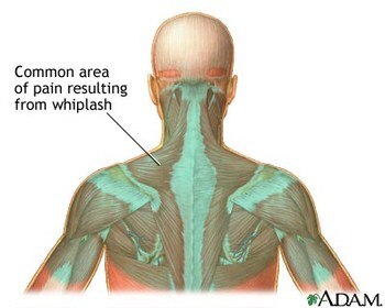 Display_image